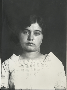 Ritratto di donna con cicatrice al collo