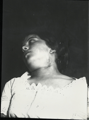 Ritratto di donna con cicatrice al collo